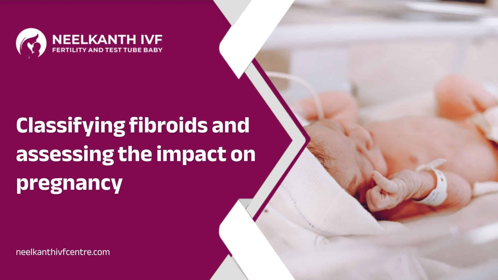 Classifying fibroids and assessing the impact on pregnancy