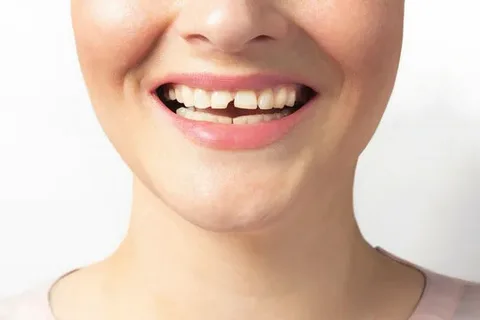 Tooth Broke in Half No Pain? Here’s What It Really Means 3 image